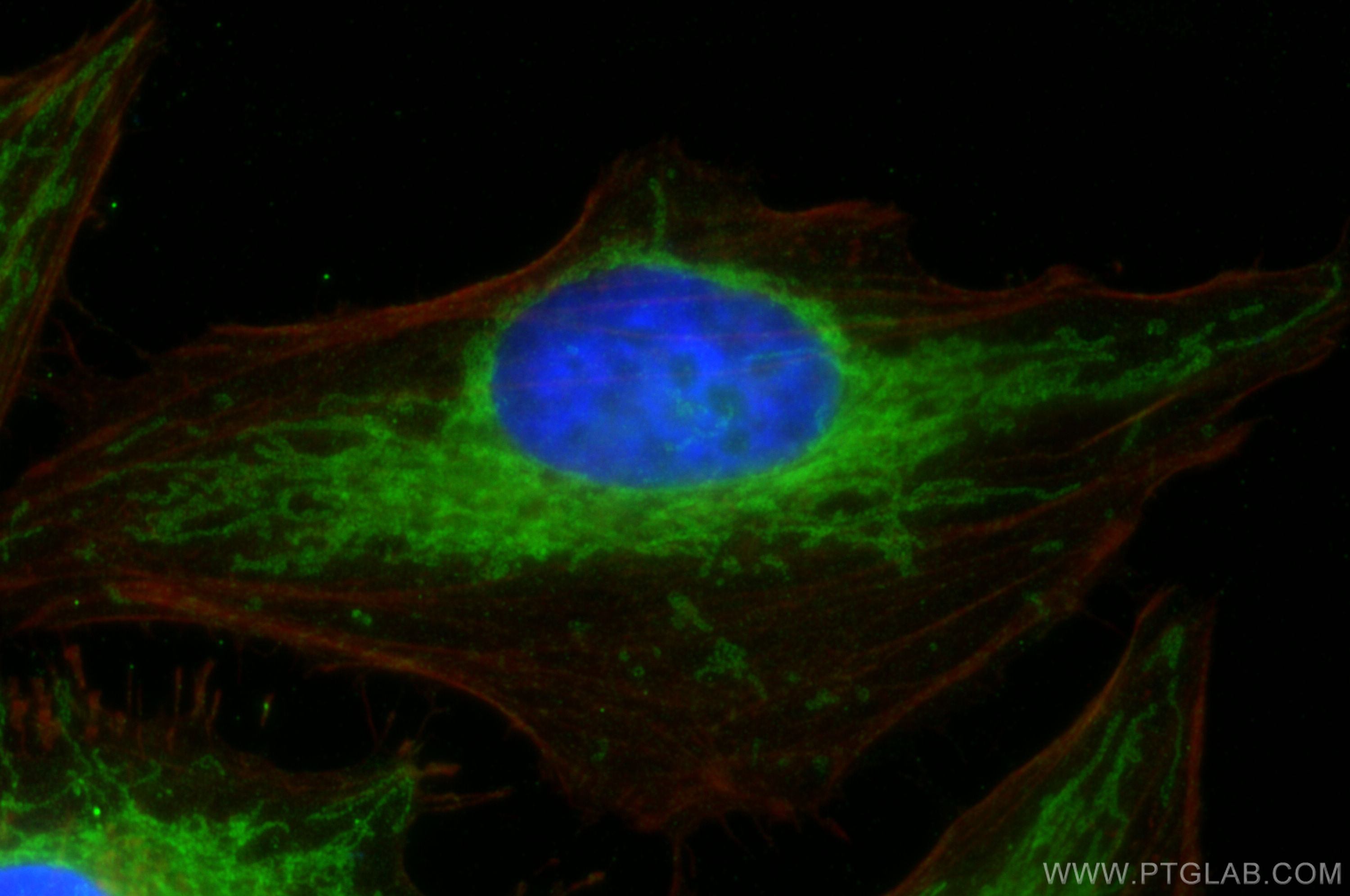 Immunofluorescence (IF) / fluorescent staining of HeLa cells using FIS1 Polyclonal antibody (10956-1-AP)