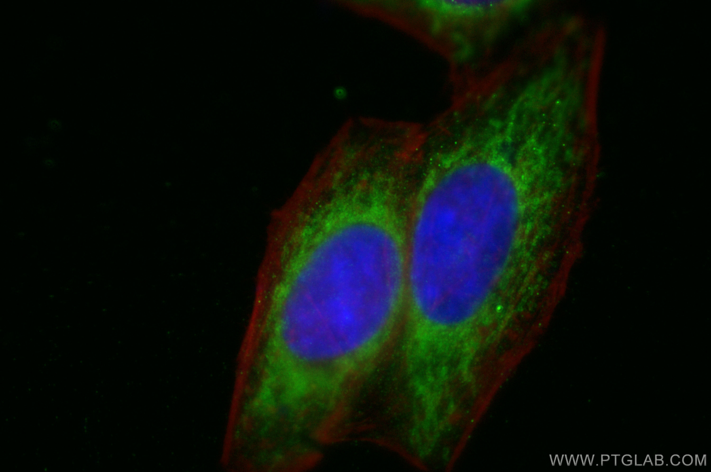 Immunofluorescence (IF) / fluorescent staining of HepG2 cells using FIS1 Monoclonal antibody (66635-1-Ig)