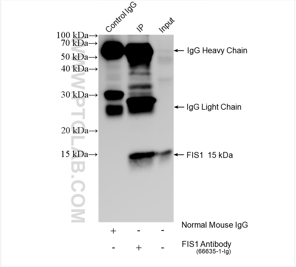 Immunoprecipitation (IP) experiment of HeLa cells using FIS1 Monoclonal antibody (66635-1-Ig)