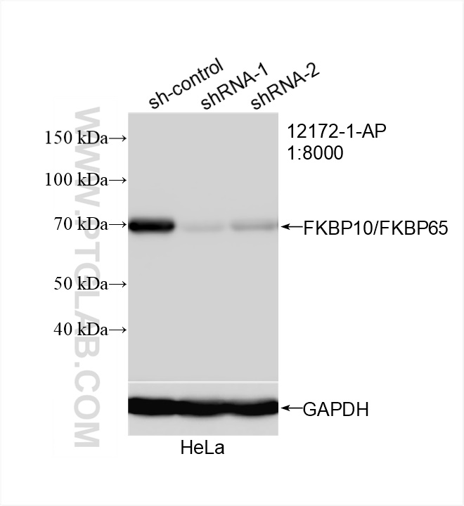 Western Blot (WB) analysis of HeLa cells using FKBP10/FKBP65 Polyclonal antibody (12172-1-AP)