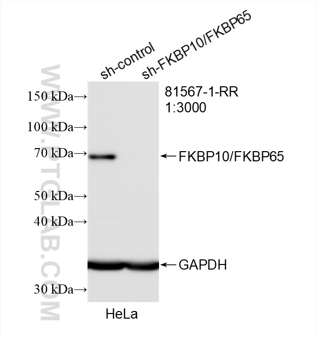 Western Blot (WB) analysis of HeLa cells using FKBP10/FKBP65 Recombinant antibody (81567-1-RR)