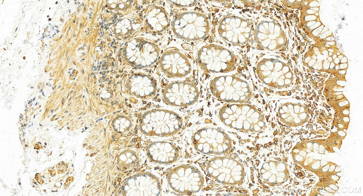 Immunohistochemistry (IHC) staining of human colon tissue using FKBP1A Polyclonal antibody (10273-1-AP)