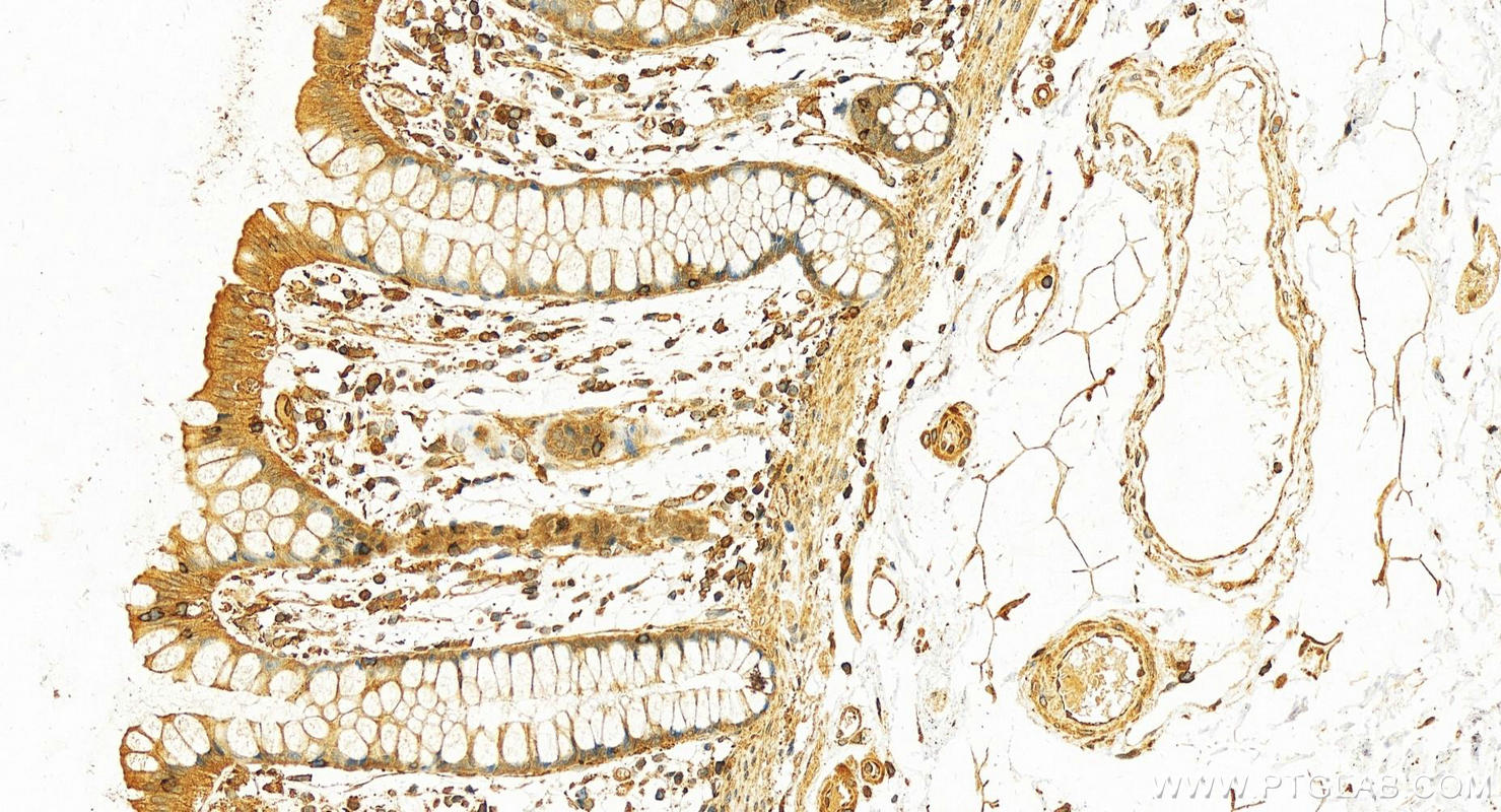 Immunohistochemistry (IHC) staining of human colon tissue using FKBP1A Polyclonal antibody (10273-1-AP)