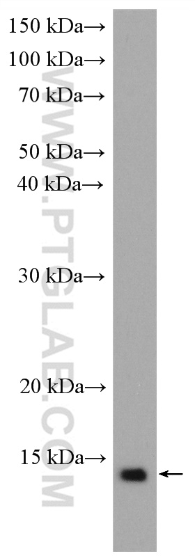 Western Blot (WB) analysis of Jurkat cells using FKBP1A Polyclonal antibody (10273-1-AP)