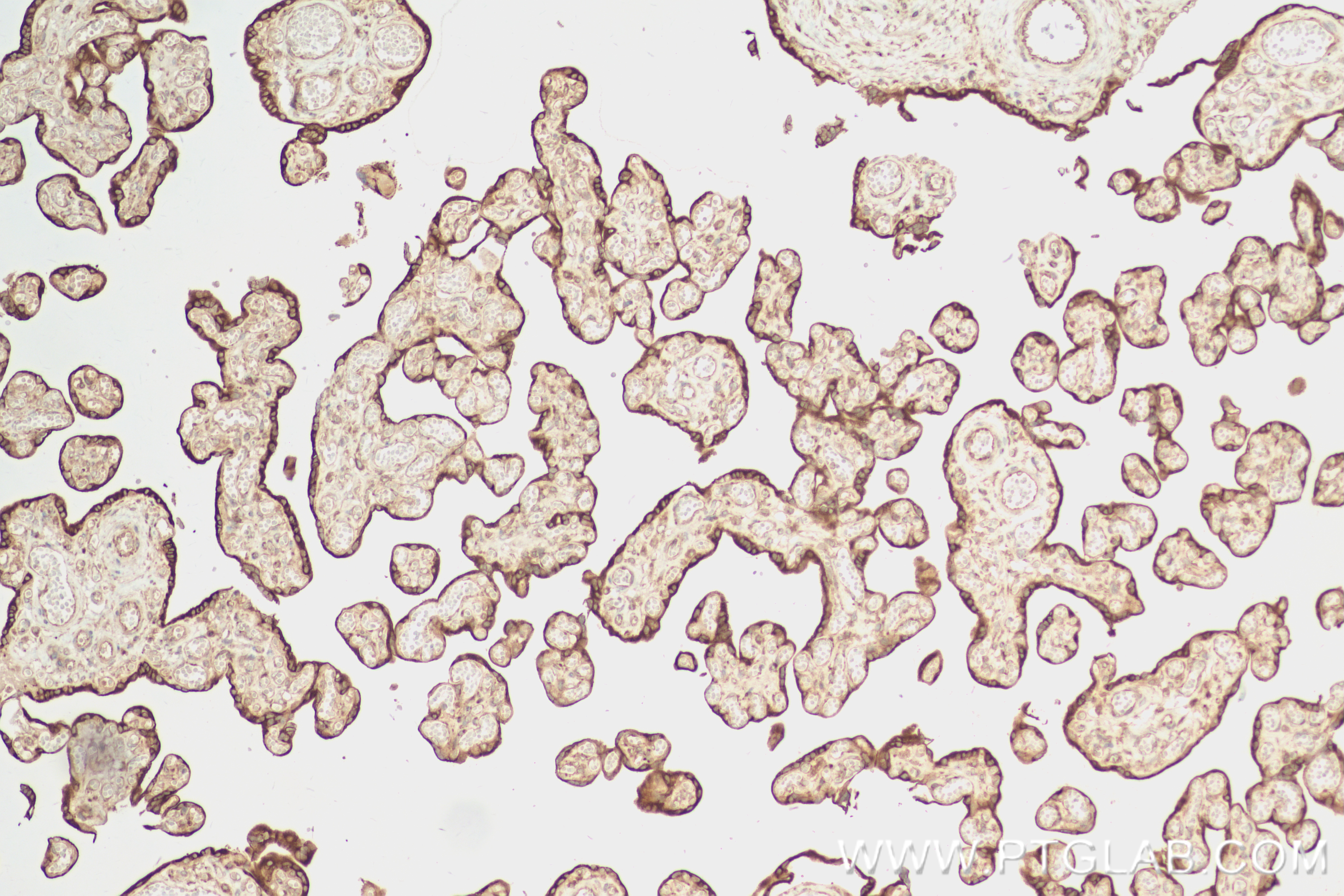 Immunohistochemistry (IHC) staining of human placenta tissue using FKBP2 Recombinant antibody (84077-6-RR)