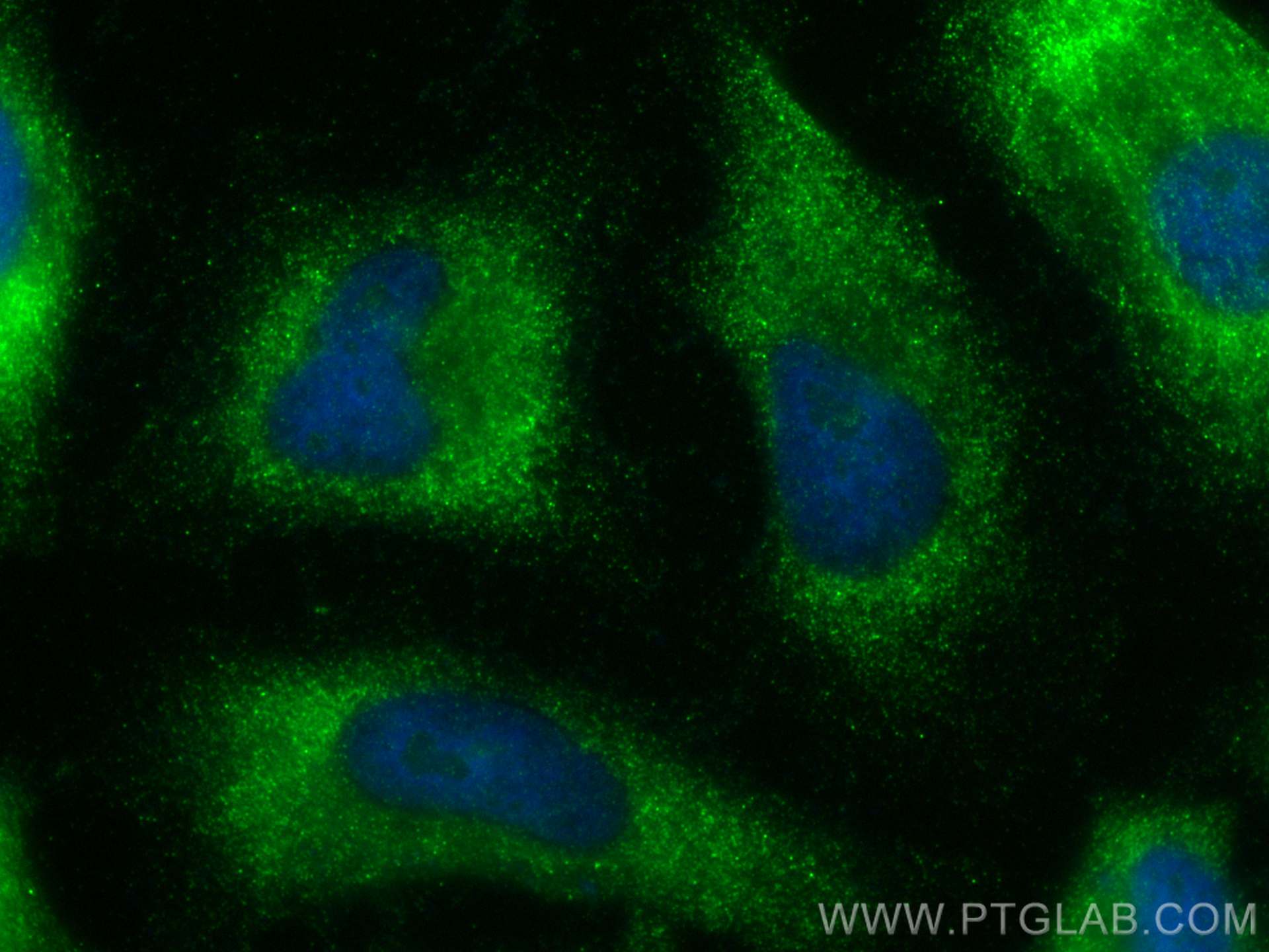 Immunofluorescence (IF) / fluorescent staining of HeLa cells using FKBP3 Polyclonal antibody (11755-1-AP)