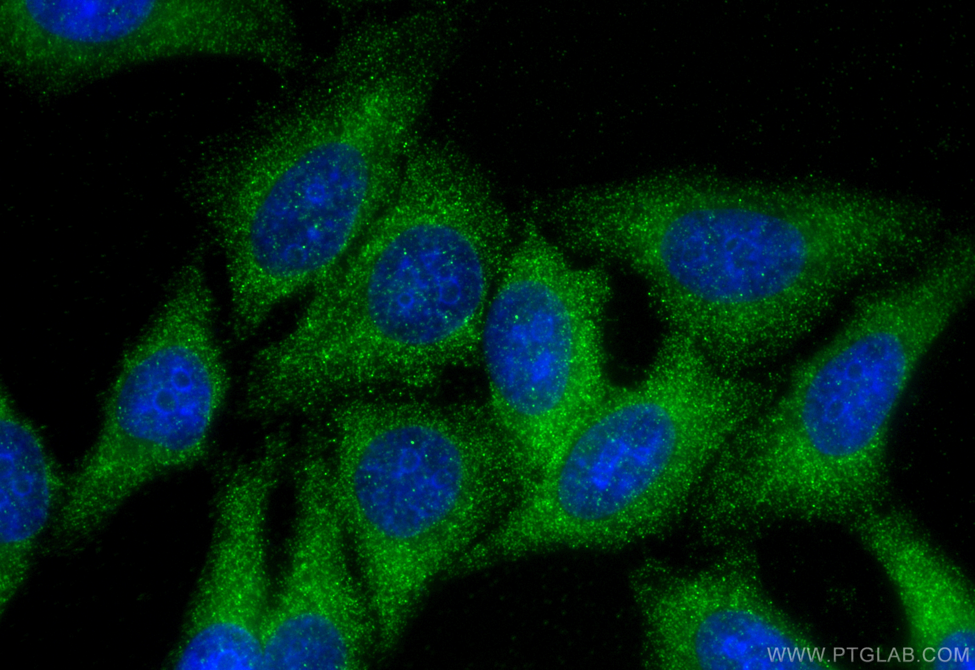 Immunofluorescence (IF) / fluorescent staining of HepG2 cells using FKBP3 Polyclonal antibody (11755-1-AP)