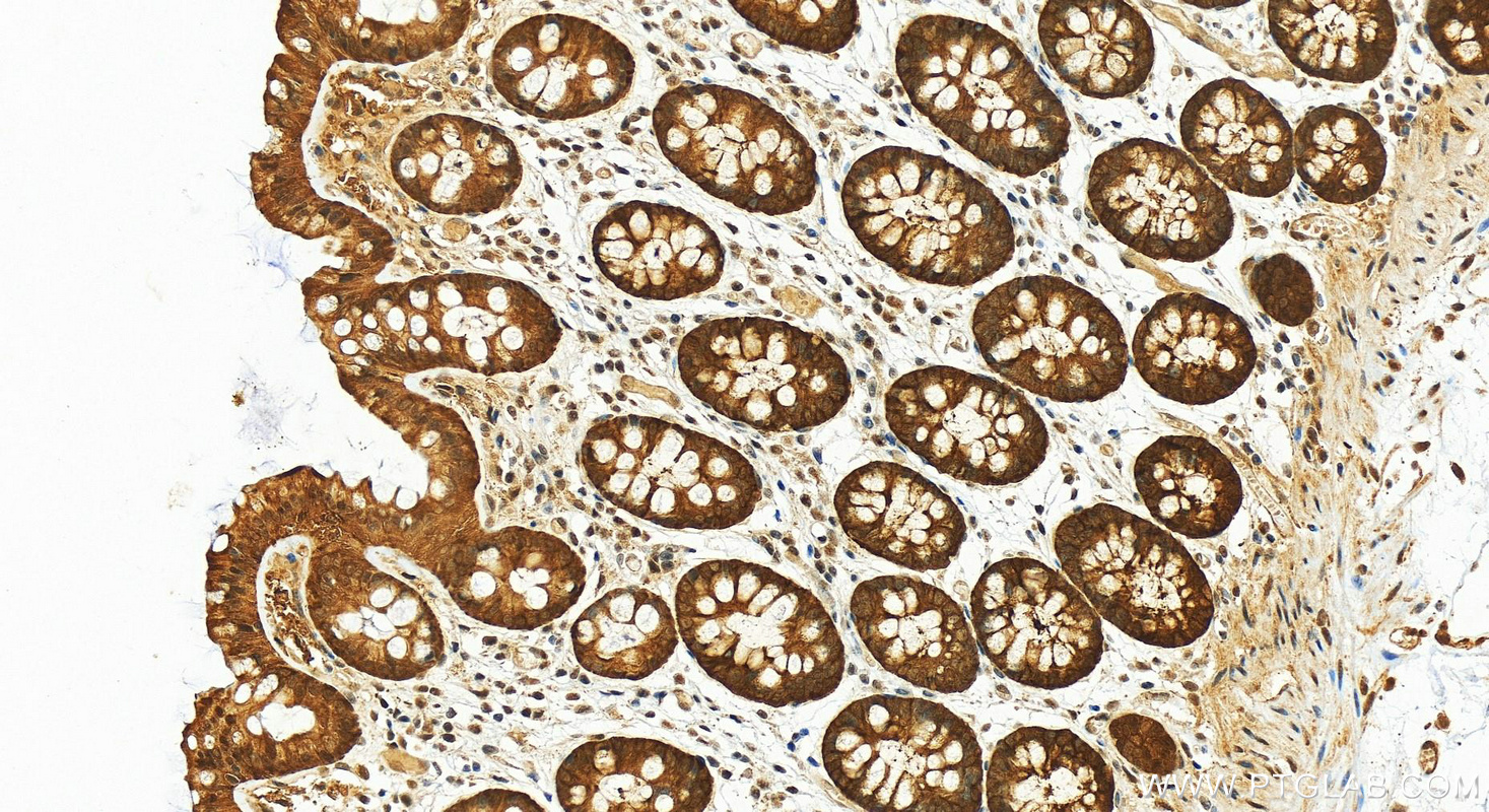 Immunohistochemistry (IHC) staining of human colon tissue using FKBP52 Polyclonal antibody (22623-1-AP)