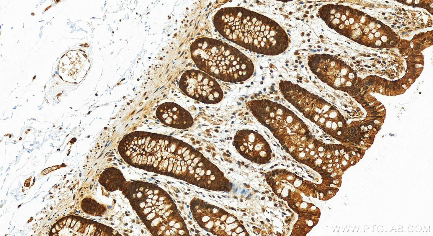 Immunohistochemistry (IHC) staining of human colon tissue using FKBP52 Polyclonal antibody (22623-1-AP)