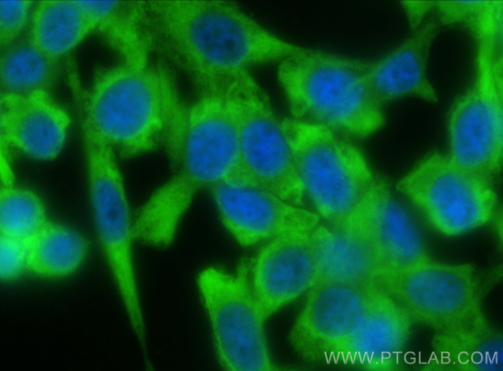 Immunofluorescence (IF) / fluorescent staining of PC-3 cells using FKBP52 Polyclonal antibody (22623-1-AP)