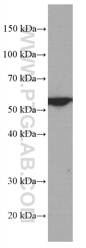 Western Blot (WB) analysis of Jurkat cells using FKBP52 Monoclonal antibody (66040-1-Ig)