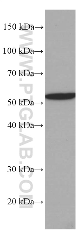 Western Blot (WB) analysis of HeLa cells using FKBP52 Monoclonal antibody (66040-1-Ig)