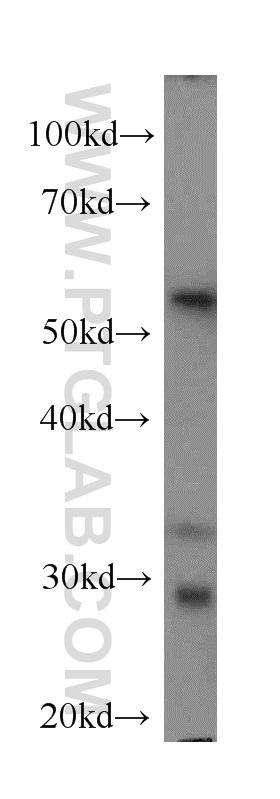 Western Blot (WB) analysis of MCF-7 cells using FKBP52 Monoclonal antibody (66040-1-Ig)