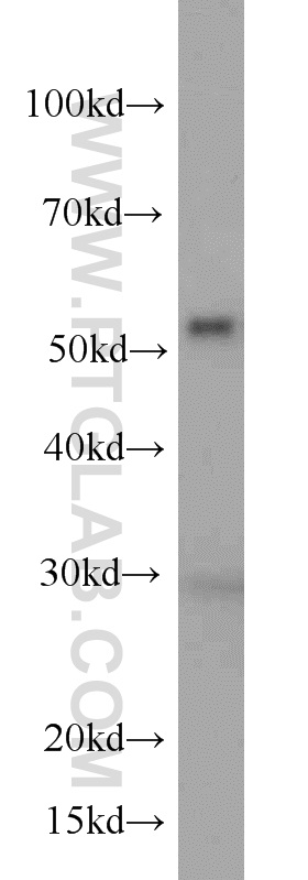 Western Blot (WB) analysis of HeLa cells using FKBP52 Monoclonal antibody (66040-1-Ig)