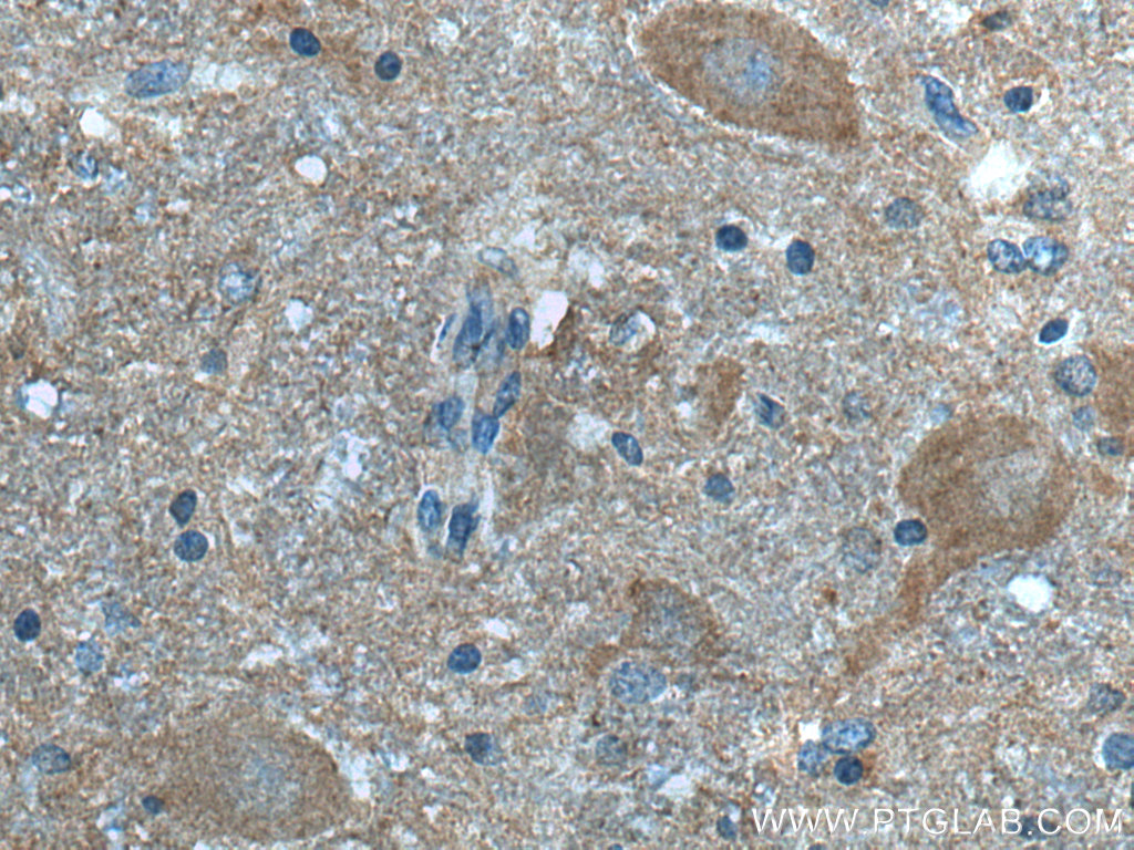 Immunohistochemistry (IHC) staining of human hypothalamus tissue using FKBP8 Monoclonal antibody (66690-1-Ig)