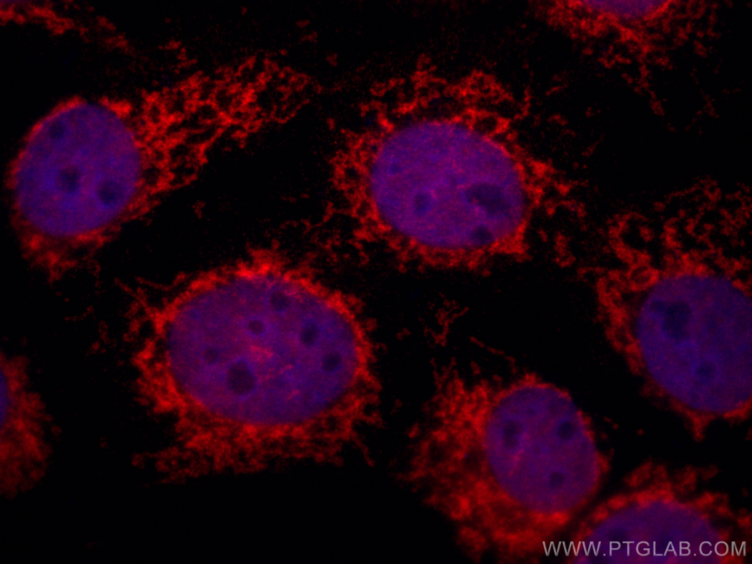 Immunofluorescence (IF) / fluorescent staining of A431 cells using CoraLite®594-conjugated FKBP8 Monoclonal antibody (CL594-66690)