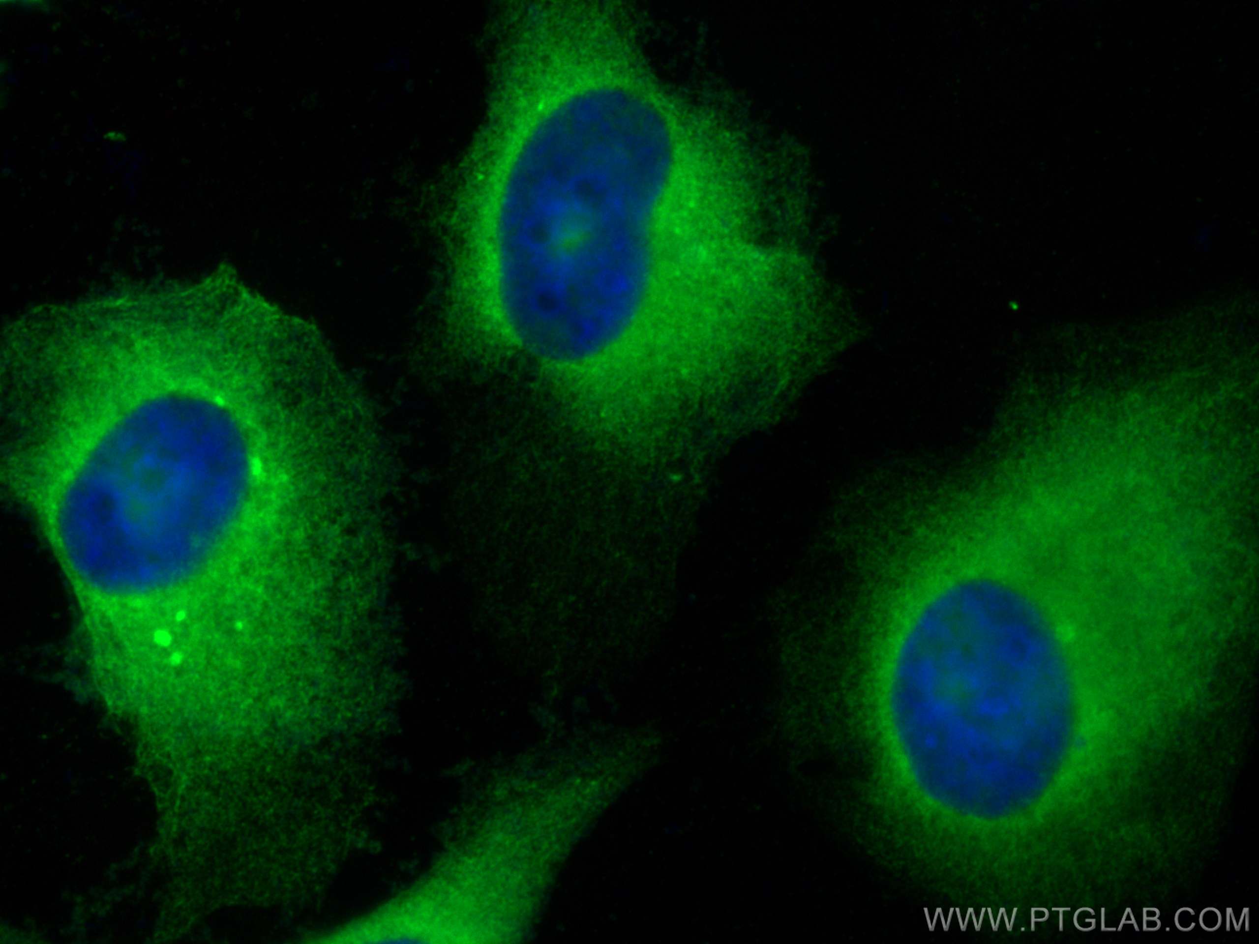 Immunofluorescence (IF) / fluorescent staining of HeLa cells using FKBPL Polyclonal antibody (23369-1-AP)