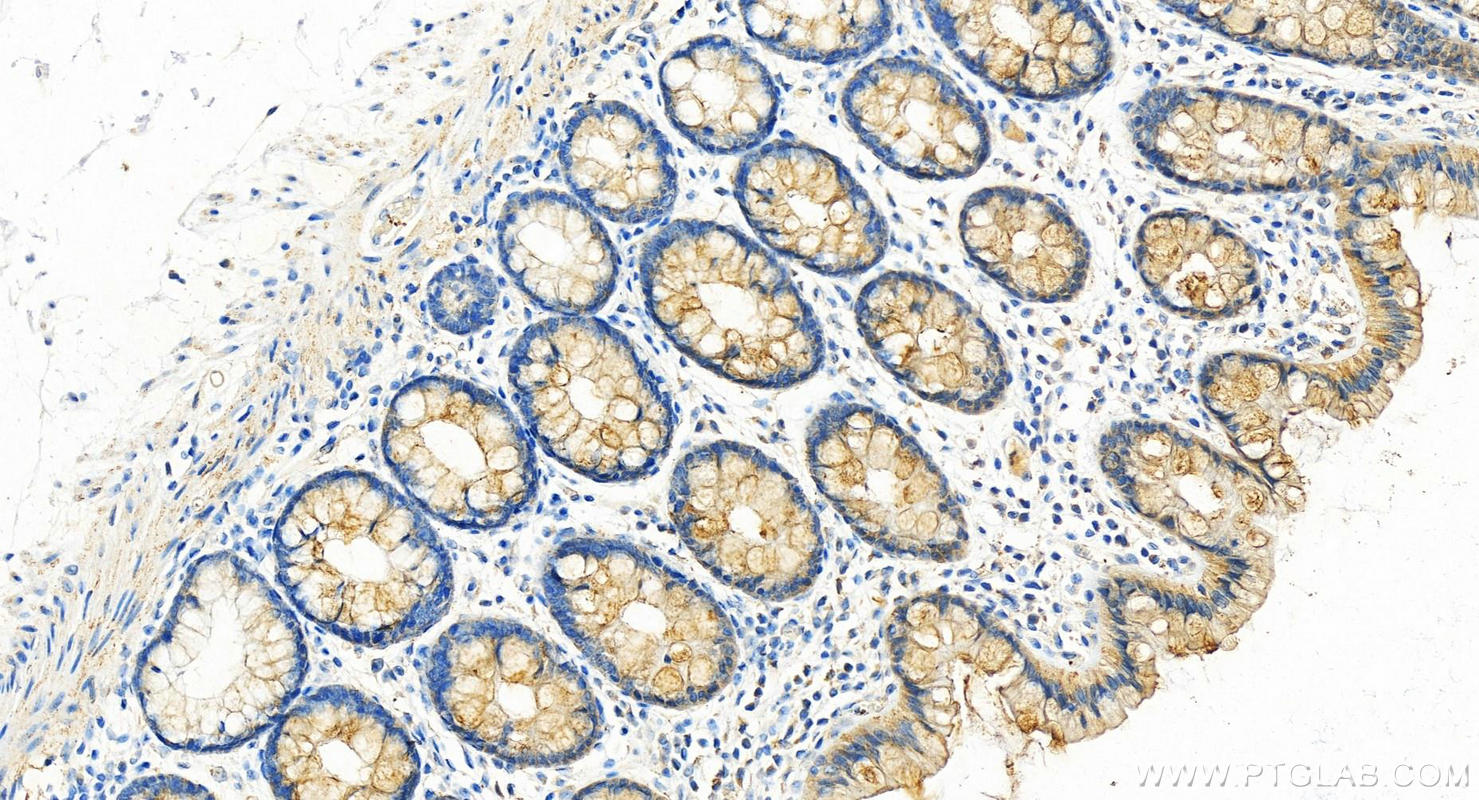 Immunohistochemistry (IHC) staining of human colon tissue using Filamin B Polyclonal antibody (20685-1-AP)