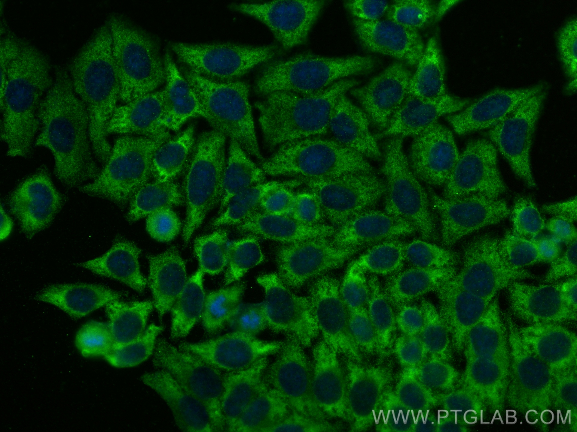 Immunofluorescence (IF) / fluorescent staining of HepG2 cells using Filamin B Polyclonal antibody (20685-1-AP)