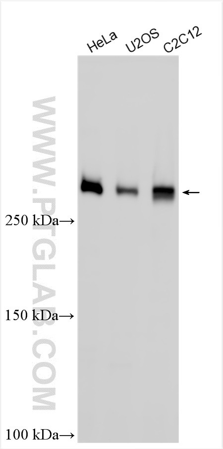 Western Blot (WB) analysis of various lysates using Filamin B Polyclonal antibody (20685-1-AP)