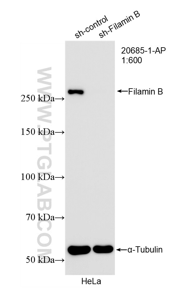 Western Blot (WB) analysis of HeLa cells using Filamin B Polyclonal antibody (20685-1-AP)