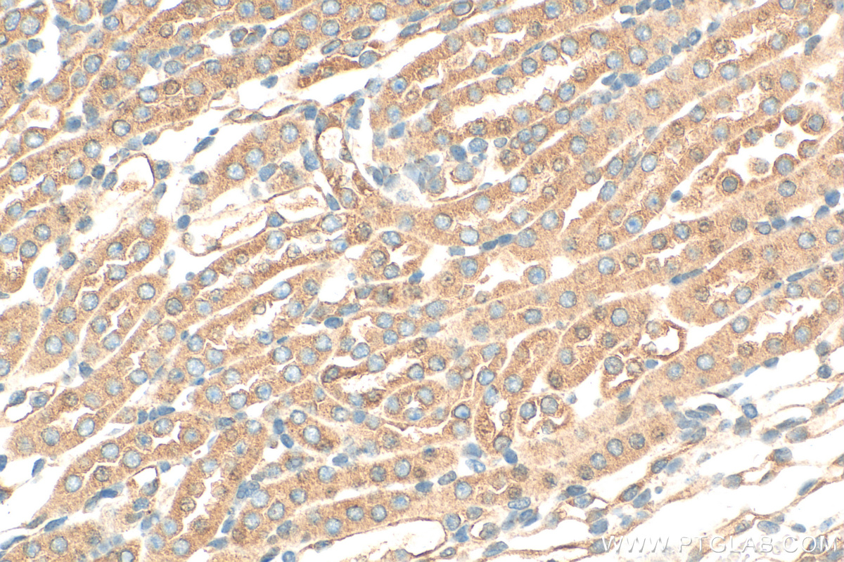 Immunohistochemistry (IHC) staining of mouse kidney tissue using FLVCR1 Polyclonal antibody (26841-1-AP)