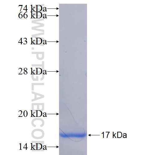 FLVCR1 fusion protein Ag25237 SDS-PAGE