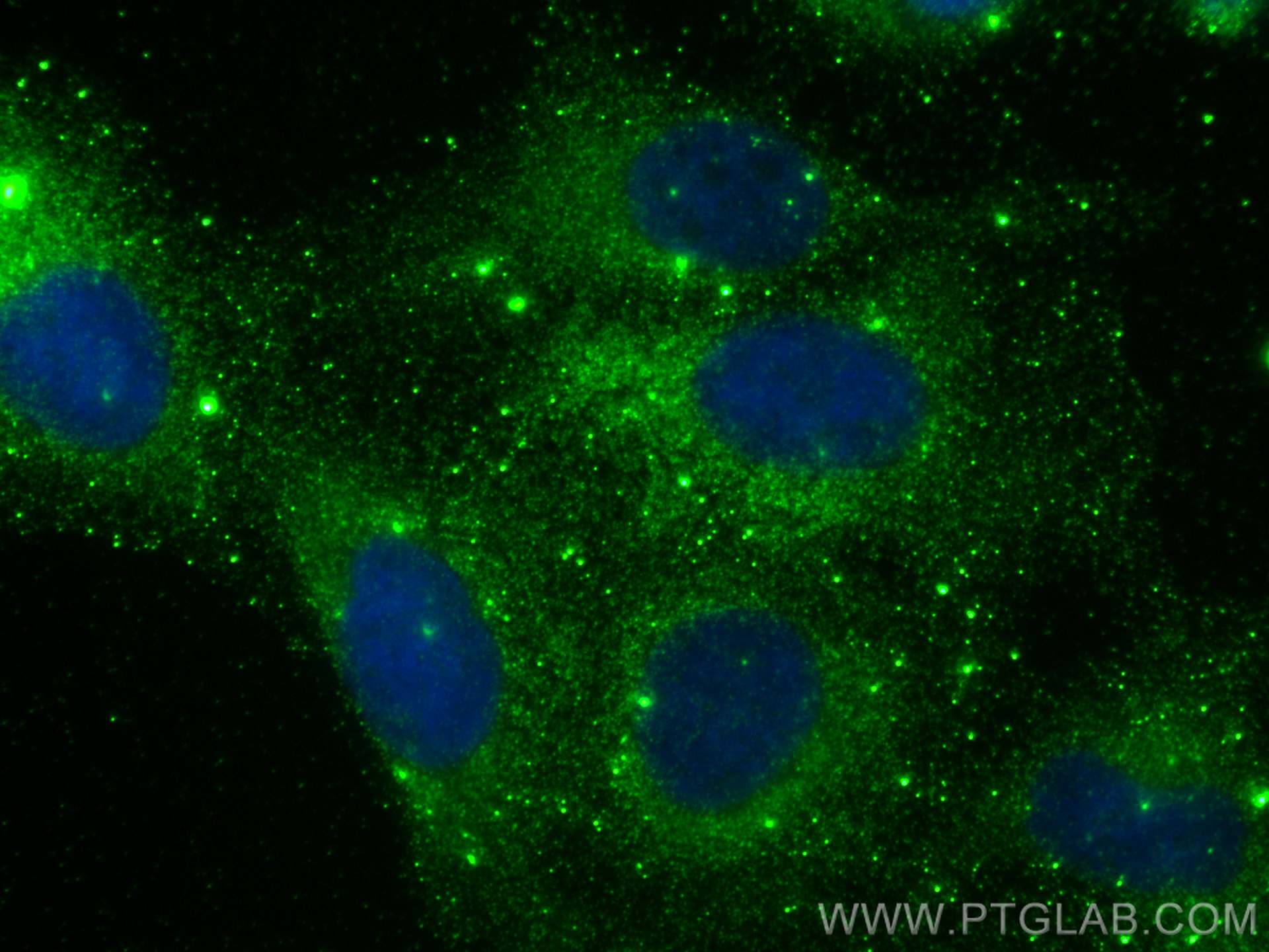 Immunofluorescence (IF) / fluorescent staining of U2OS cells using FMNL1 Monoclonal antibody (67587-1-Ig)