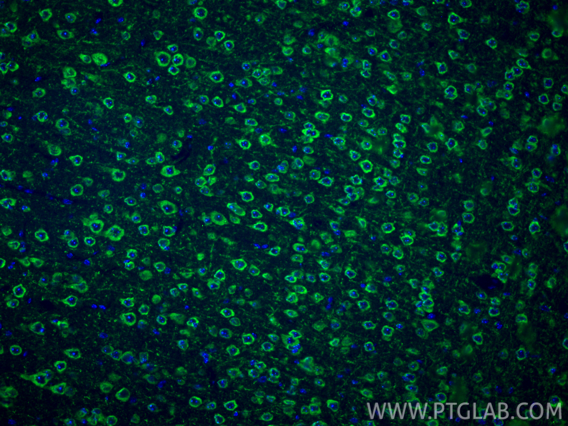 Immunofluorescence (IF) / fluorescent staining of mouse brain tissue using FMRP Polyclonal antibody (13755-1-AP)