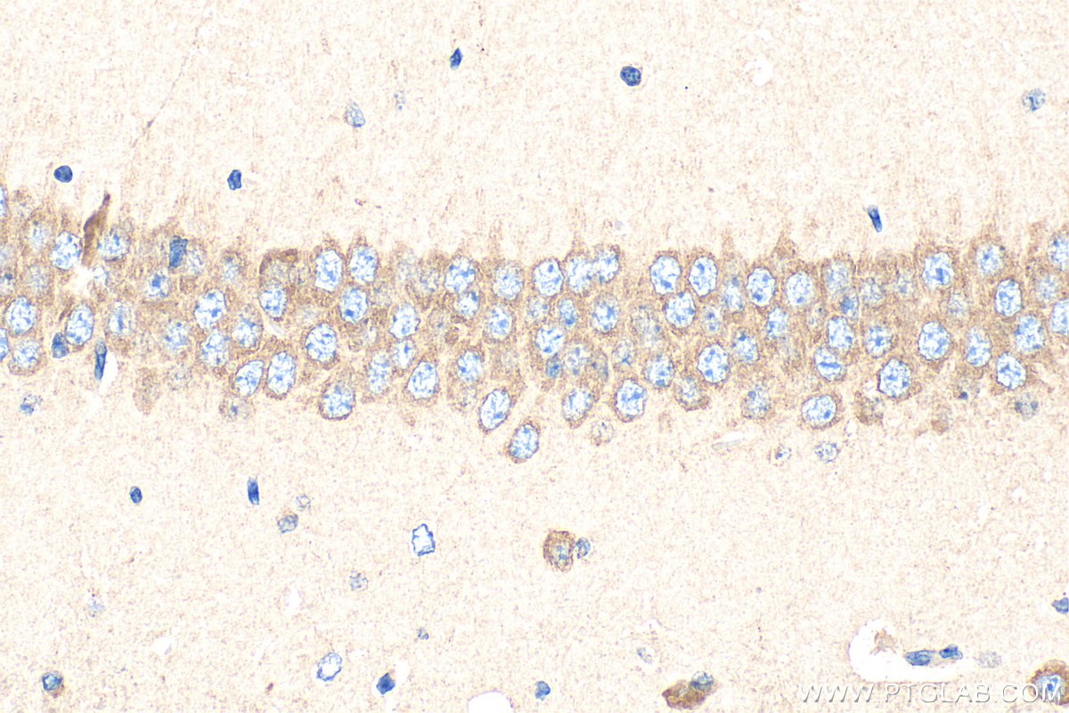 Immunohistochemistry (IHC) staining of mouse brain tissue using FMR1 Polyclonal antibody (13755-1-AP)