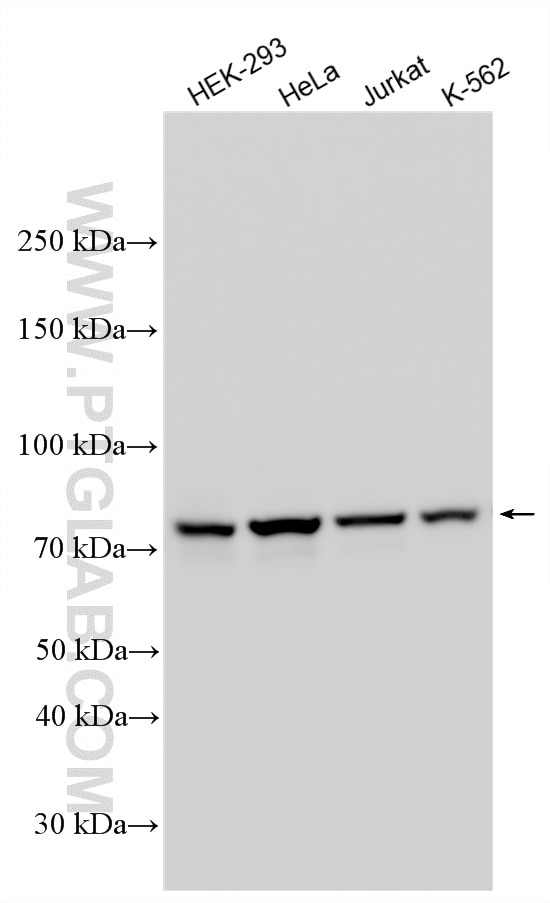 Western Blot (WB) analysis of various lysates using FMRP Polyclonal antibody (13755-1-AP)