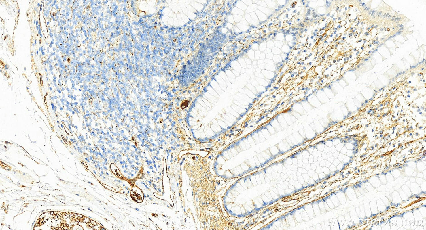 Immunohistochemistry (IHC) staining of human normal colon using Fibronectin Polyclonal antibody (15613-1-AP)