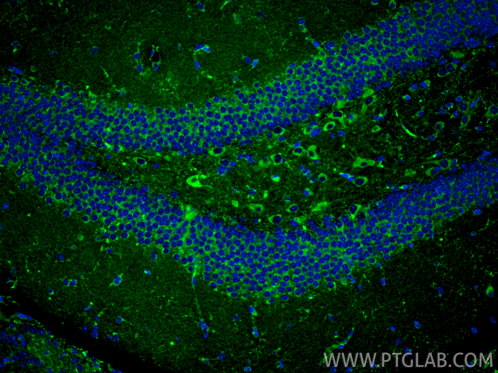 Immunofluorescence (IF) / fluorescent staining of mouse brain tissue using Fibronectin Polyclonal antibody (15613-1-AP)