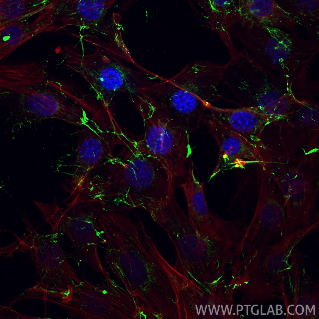 Immunofluorescence (IF) / fluorescent staining of NIH/3T3 cells using Fibronectin Polyclonal antibody (15613-1-AP)