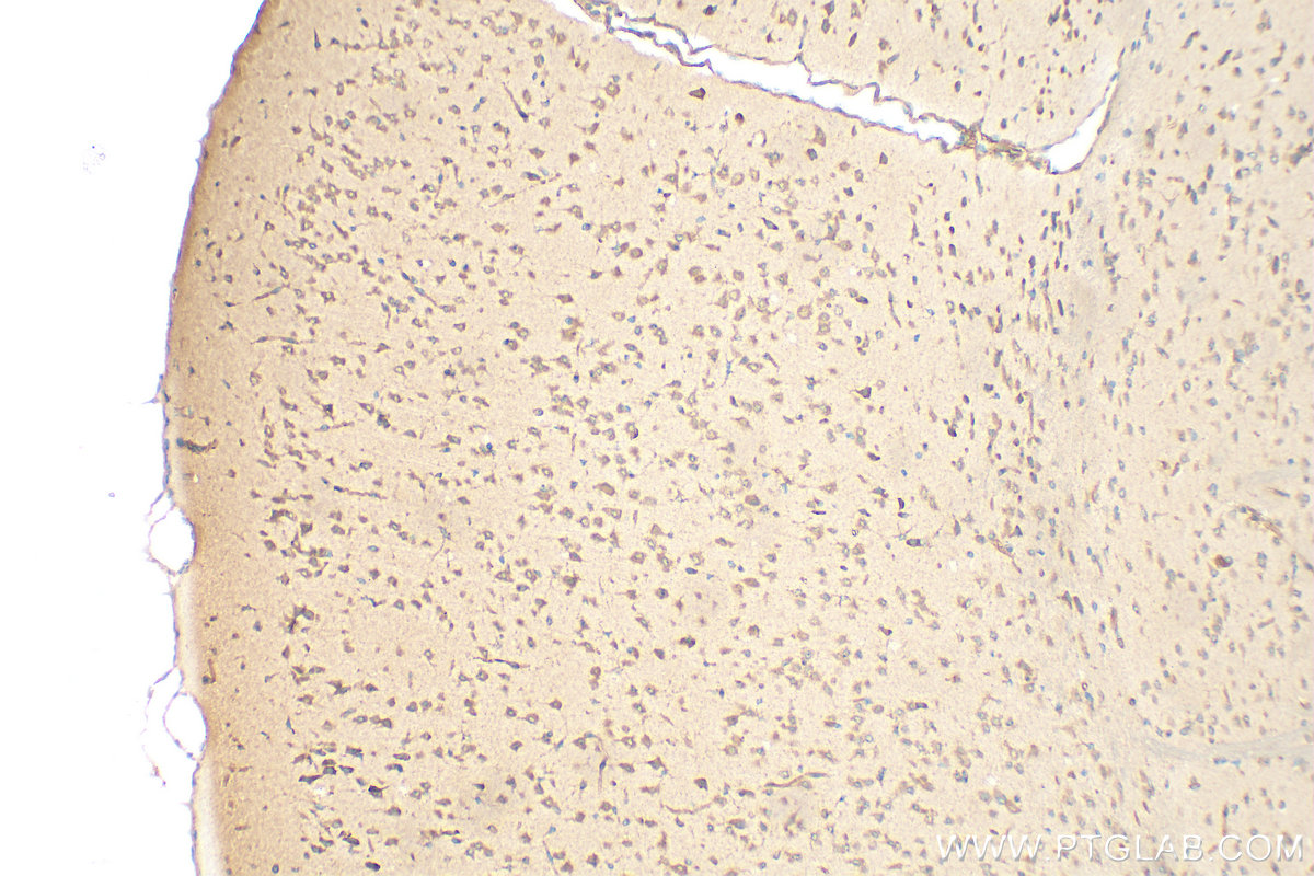 Immunohistochemistry (IHC) staining of mouse brain tissue using FNDC5 Polyclonal antibody (23995-1-AP)