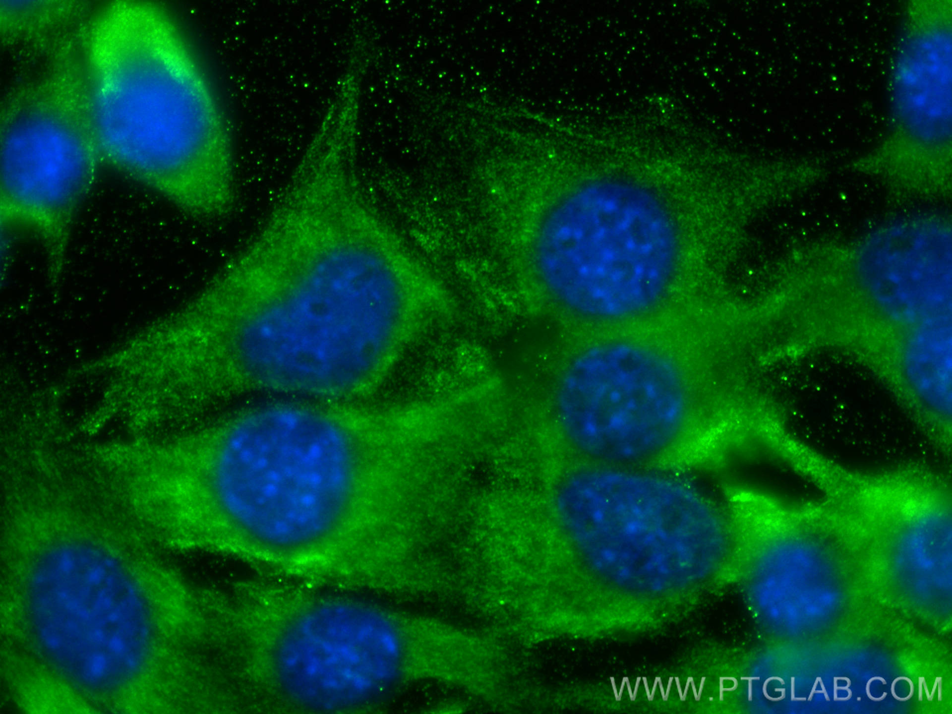 Immunofluorescence (IF) / fluorescent staining of C2C12 cells using FNIP1 Polyclonal antibody (28380-1-AP)