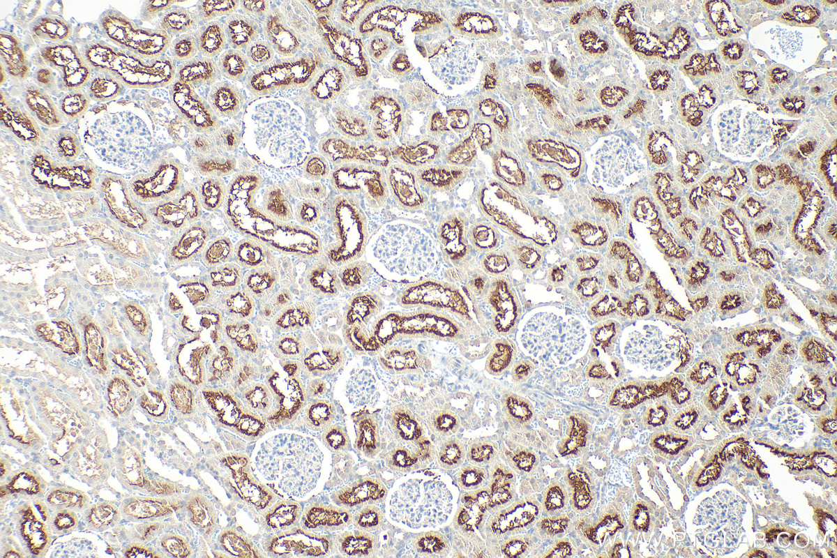 Immunohistochemistry (IHC) staining of rat kidney tissue using PSMA/GCPII Polyclonal antibody (13163-1-AP)