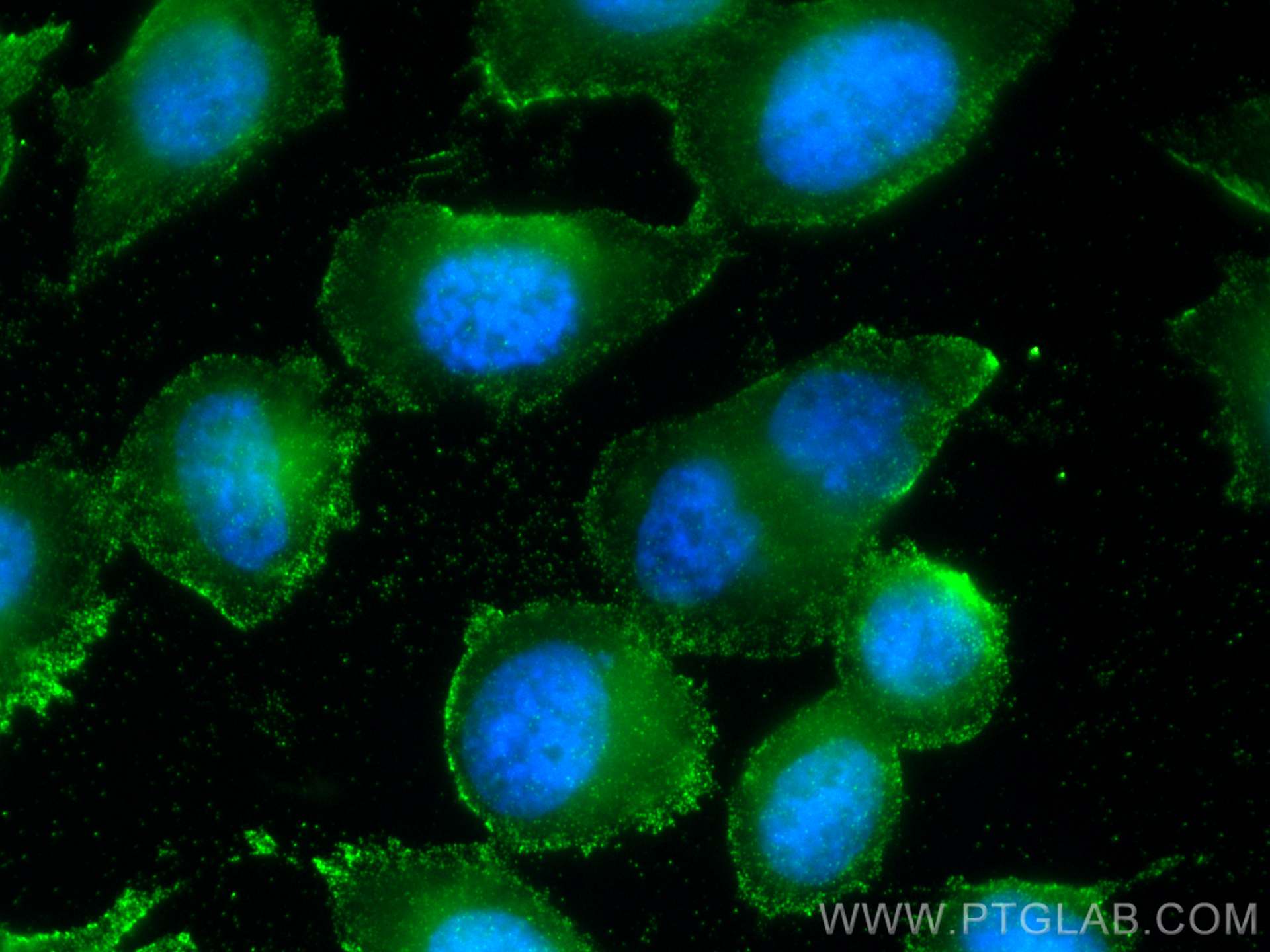 Immunofluorescence (IF) / fluorescent staining of PC-3 cells using PSMA/GCPII Monoclonal antibody (66678-1-Ig)