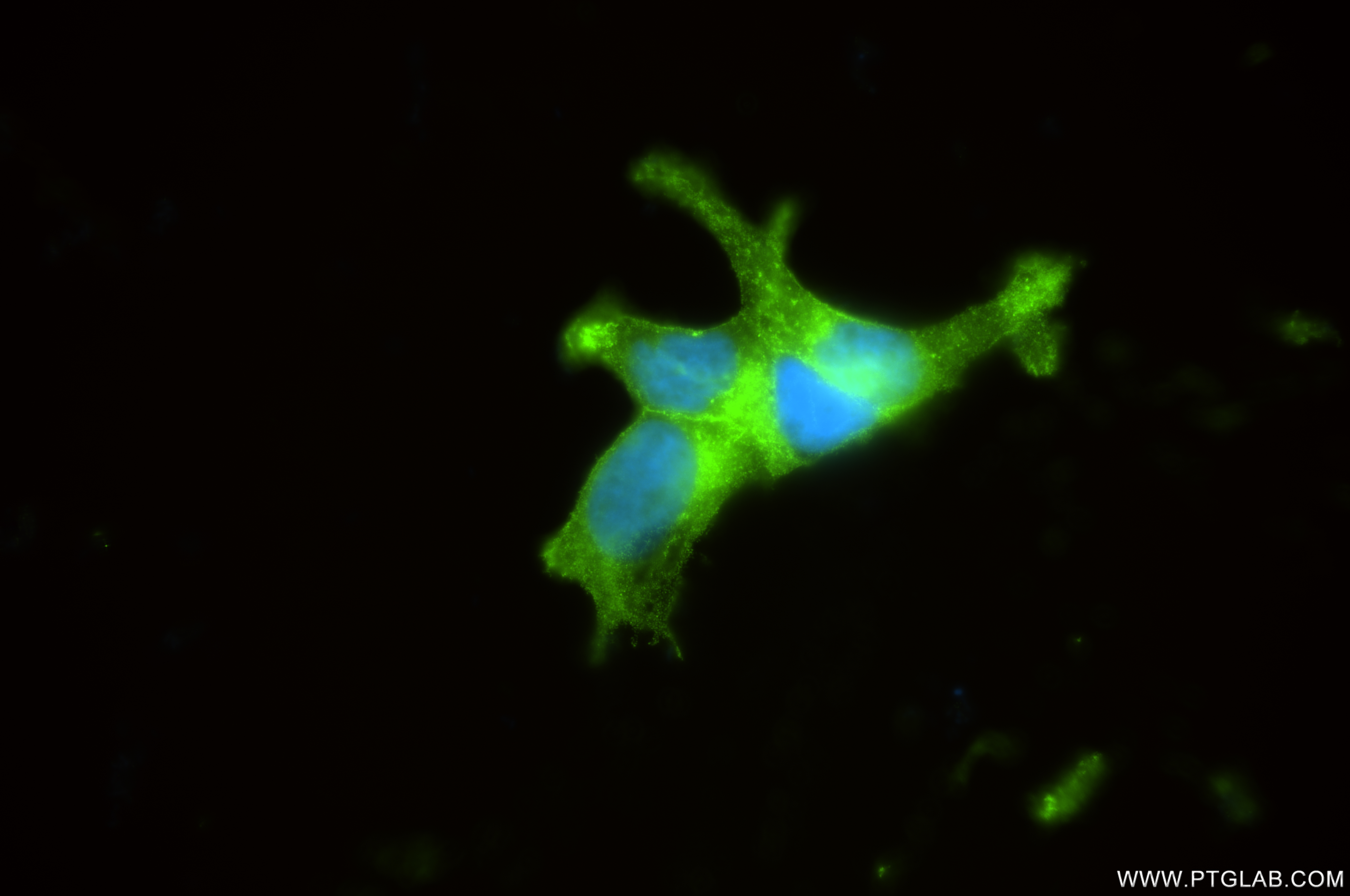 Immunofluorescence (IF) / fluorescent staining of LNCaP cells using PSMA/GCPII Recombinant antibody (84615-2-RR)