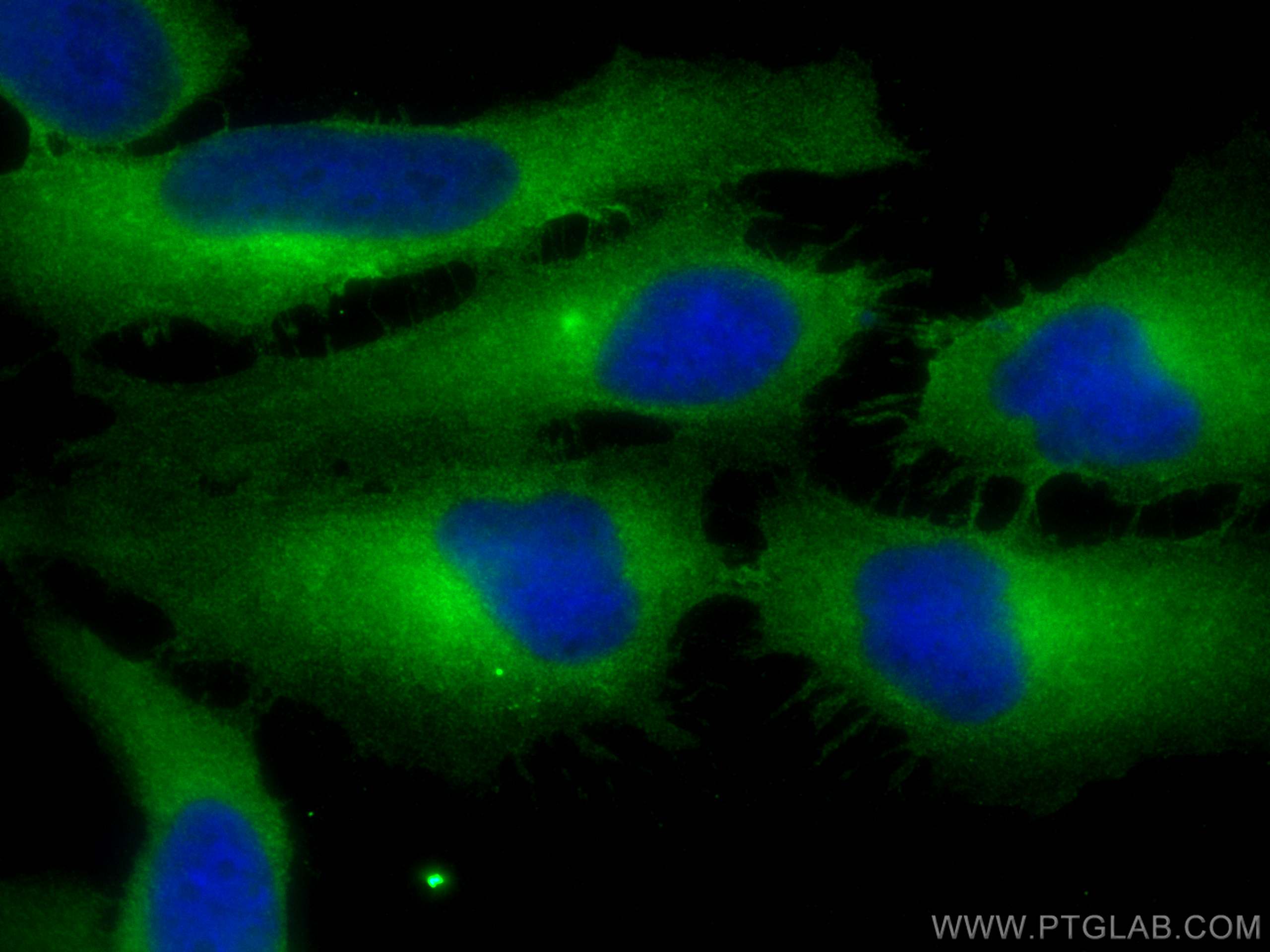 Immunofluorescence (IF) / fluorescent staining of HeLa cells using FOLR1 Polyclonal antibody (23355-1-AP)