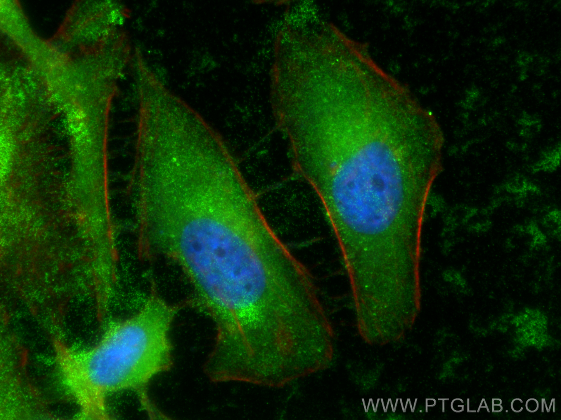 Immunofluorescence (IF) / fluorescent staining of HeLa cells using FOLR2 Polyclonal antibody (31264-1-AP)