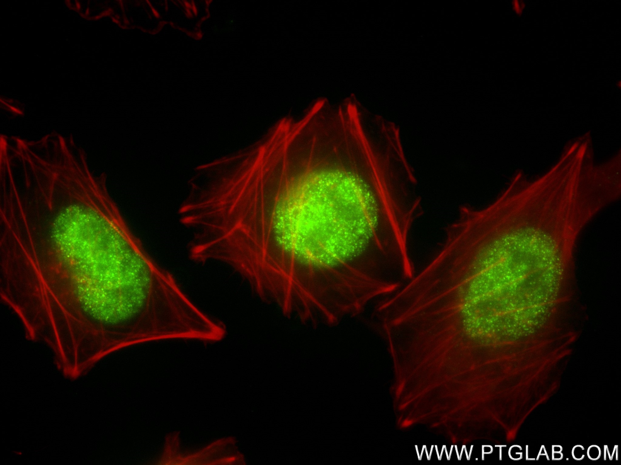 Immunofluorescence (IF) / fluorescent staining of A375 cells using FOXC2 Recombinant antibody (83476-5-RR)