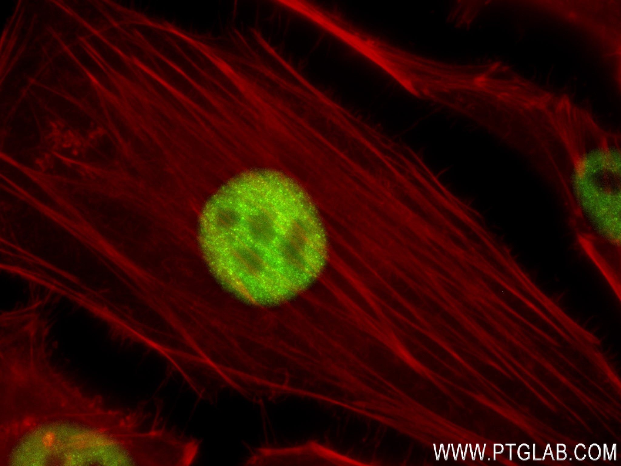 Immunofluorescence (IF) / fluorescent staining of HeLa cells using FOXF1 Recombinant antibody (84020-3-RR)