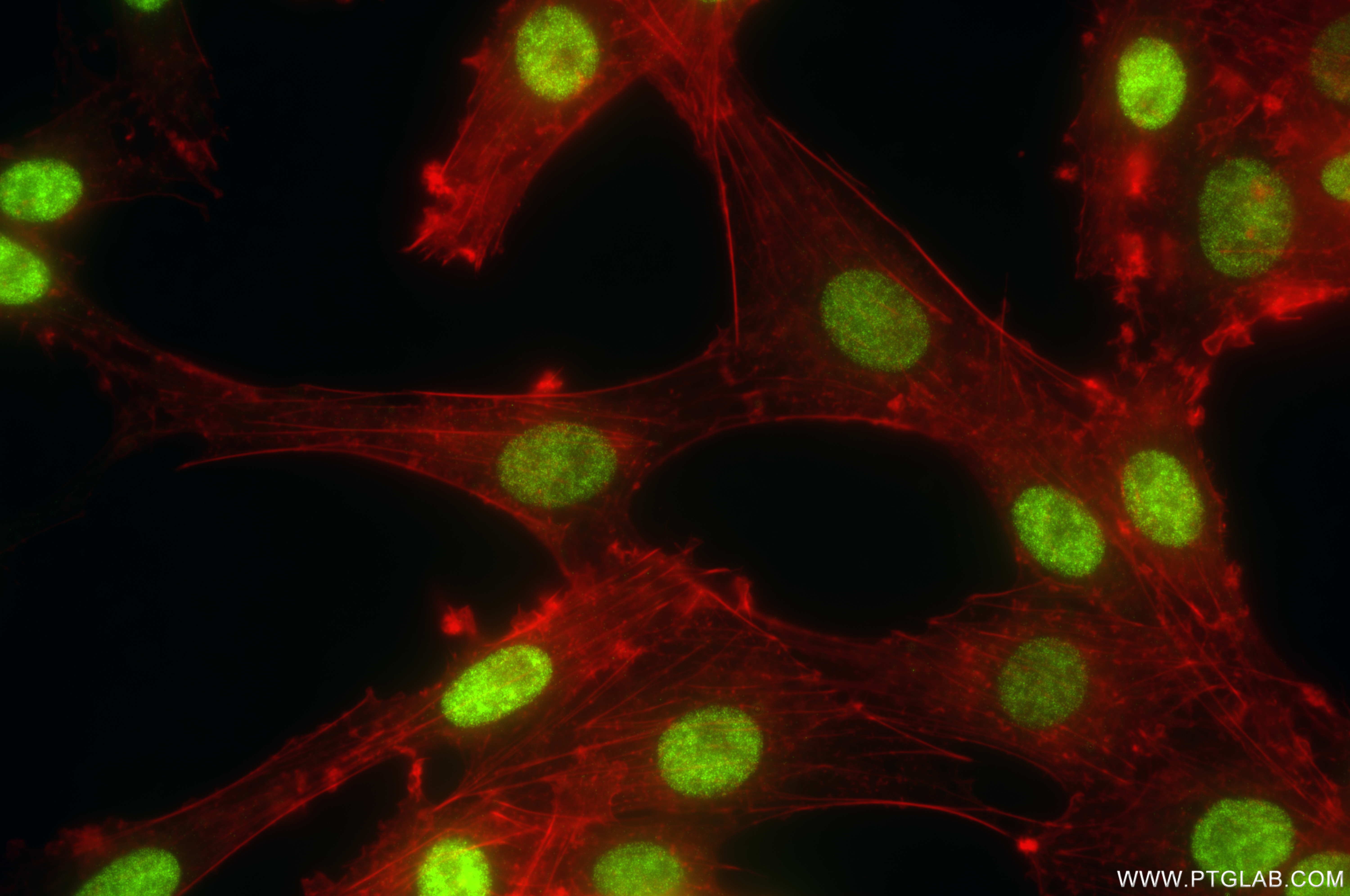 Immunofluorescence (IF) / fluorescent staining of C6 cells using FOXG1 Recombinant antibody (85930-1-RR)