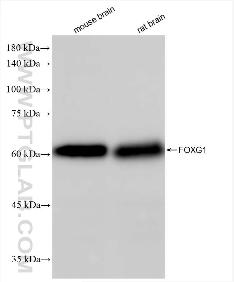 Western Blot (WB) analysis of various lysates using FOXG1 Recombinant antibody (85930-1-RR)
