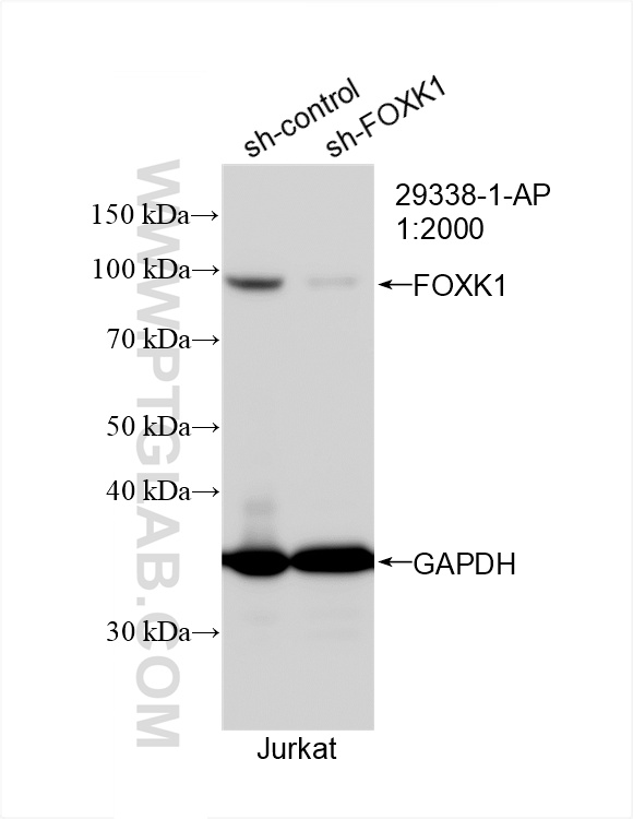 Western Blot (WB) analysis of Jurkat cells using FOXK1 Polyclonal antibody (29338-1-AP)