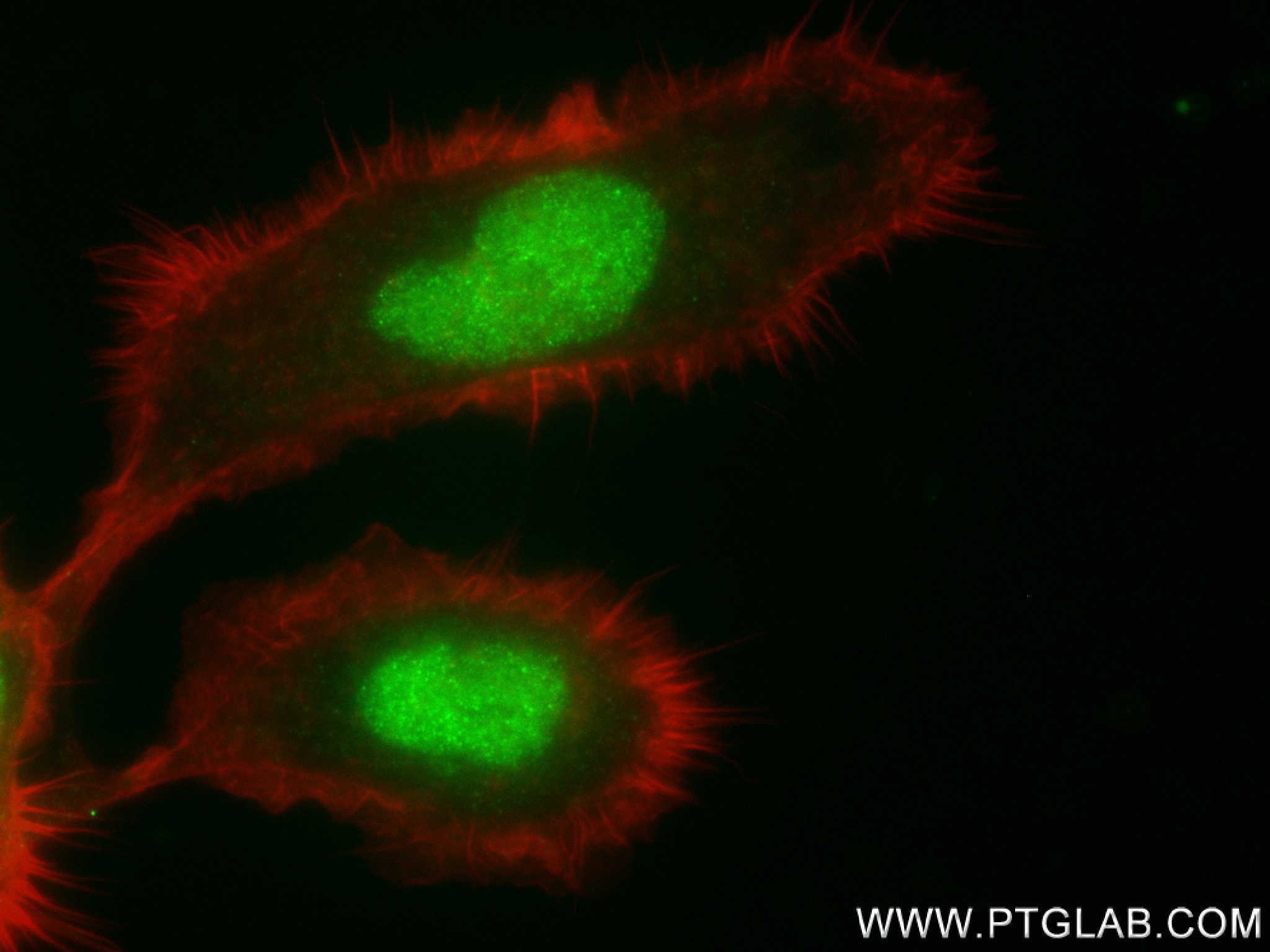 Immunofluorescence (IF) / fluorescent staining of A431 cells using FOXK2 Recombinant antibody (83735-4-RR)