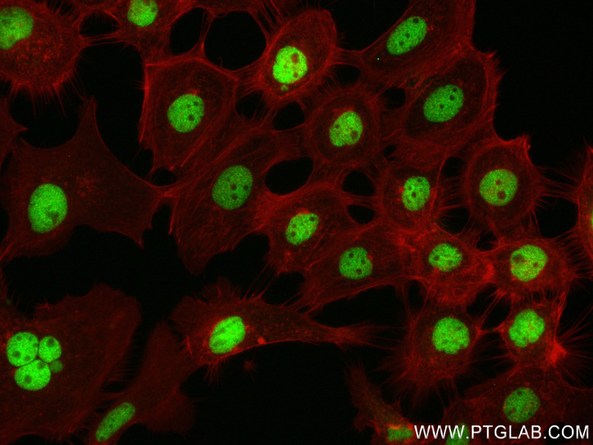 Immunofluorescence (IF) / fluorescent staining of A431 cells using FOXK2 Recombinant antibody (83735-4-RR)