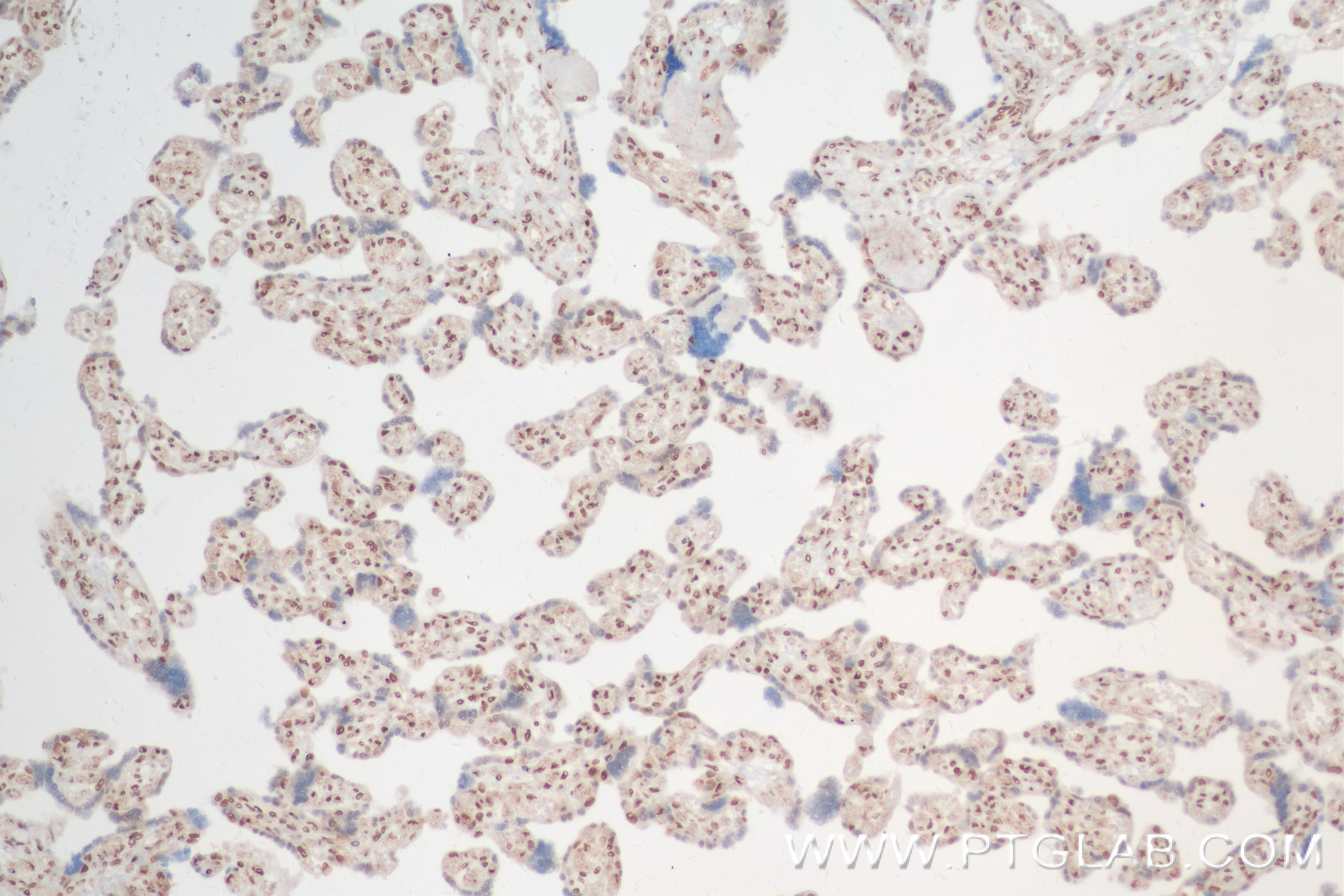 Immunohistochemistry (IHC) staining of human placenta tissue using FOXK2 Recombinant antibody (83735-4-RR)