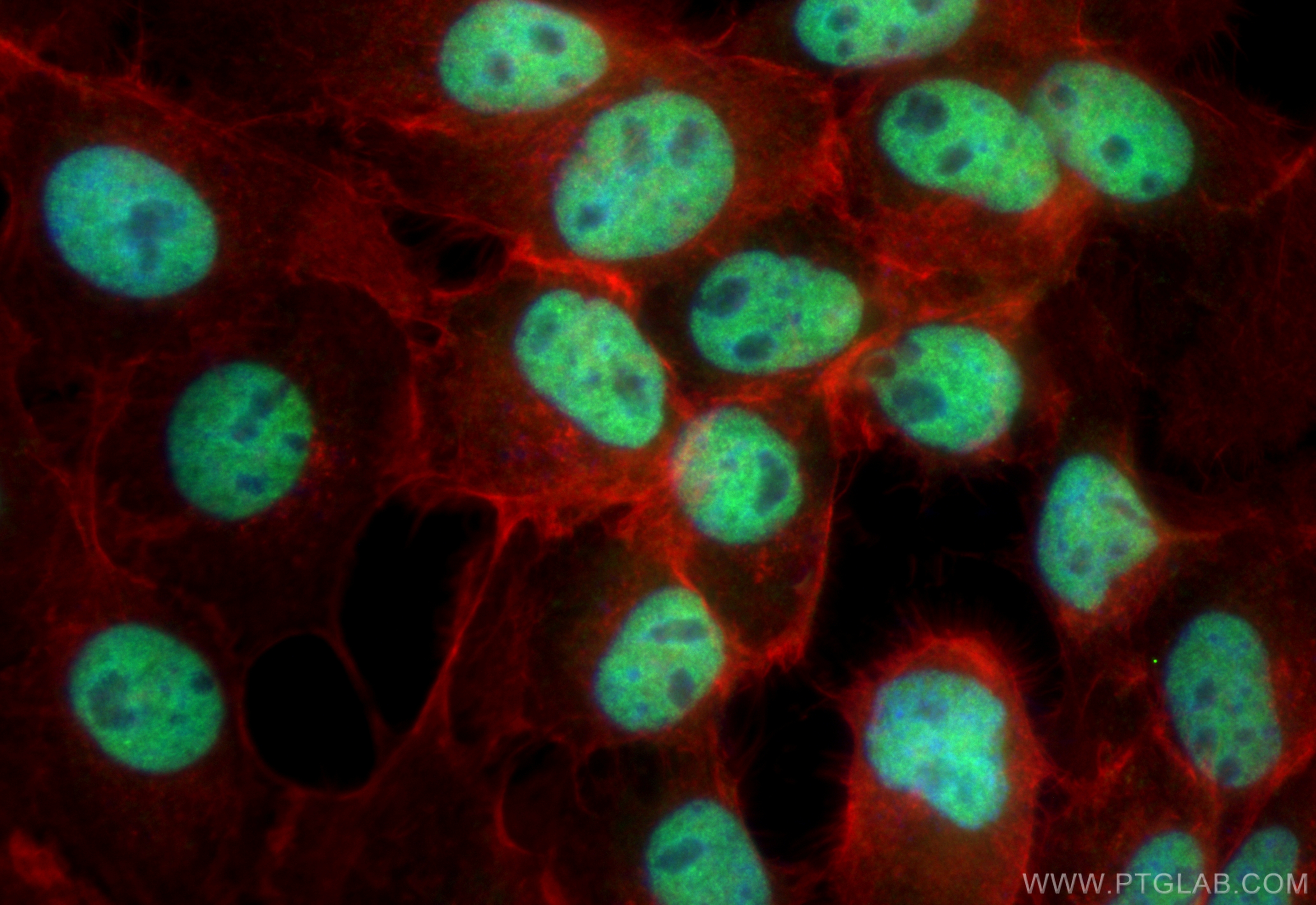 Immunofluorescence (IF) / fluorescent staining of A431 cells using CoraLite® Plus 488-conjugated FOXK2 Recombinant an (CL488-83735-4)